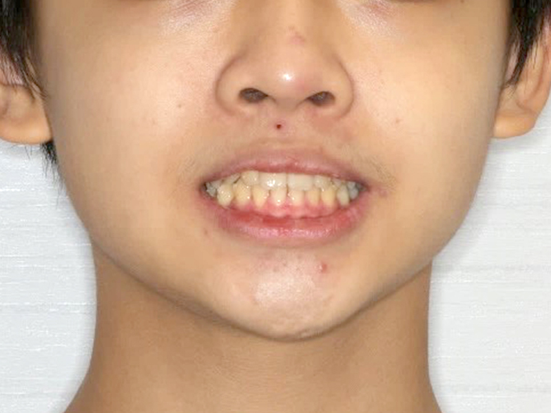 小小型男打造計畫